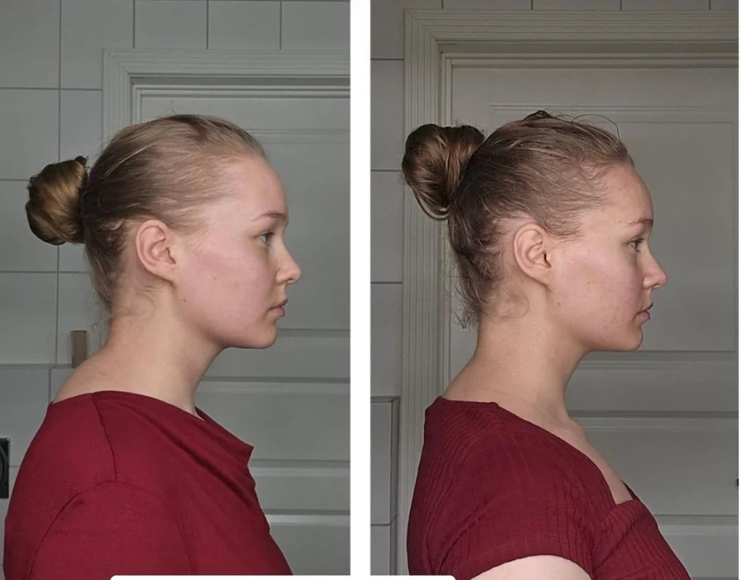 Neck and Shoulder Relaxer For Cervical Spine Alignment
